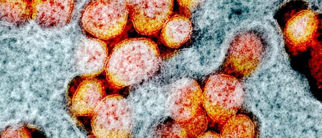 O mutație rară pare să ofere rezistență naturală la toate virusurile