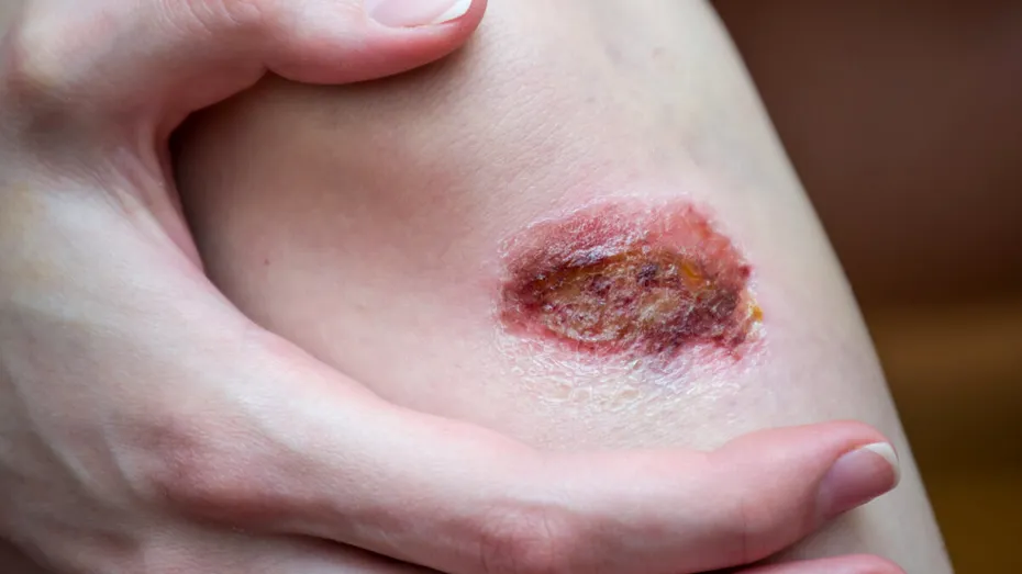 Când schimbările cutanate pot ascunde alte boli — ce semnale nu ar trebui ignorate