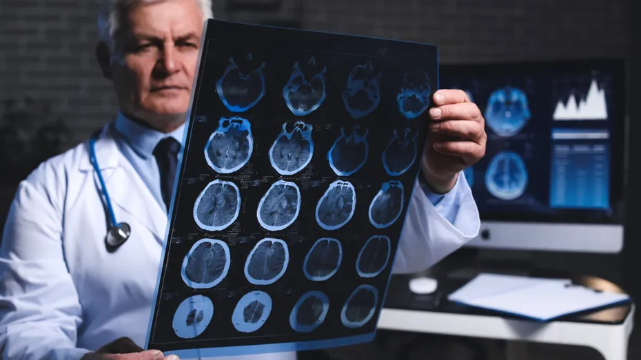 Semnul real care ar putea prevesti demența — și nu e pierderea memoriei