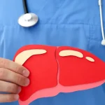 Boala silențioasă care afectează milioane de români. „Ficatul gras” poate fi ținut sub control cu doar câteva schimbări alimentare