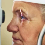 Glaucomul — „hoțul tăcut al vederii” care te poate lăsa fără vedere fără avertisment