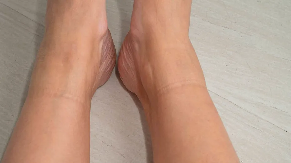 Linia neobișnuită de pe picior care poate semnala afecțiuni cardiovasculare: simptome ce nu trebuie ignorate