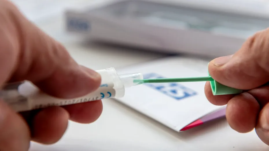 Sânge în scaun: investigațiile pe care medicii recomandă să nu le amâni