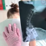 Postura copilului nu se corectează singură. Ce spun specialiștii despre sănătatea coloanei vertebrale
