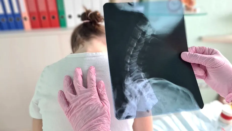 Postura copilului nu se corectează singură. Ce spun specialiștii despre sănătatea coloanei vertebrale
