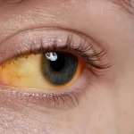 8 semne care pot indica probleme ale ficatului. Simptomele ce nu ar trebui ignorate